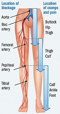 Leg Pain Causes 