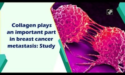 What Type of Collagen Causes Breast Cancer?here knows about 14 types of collagen.