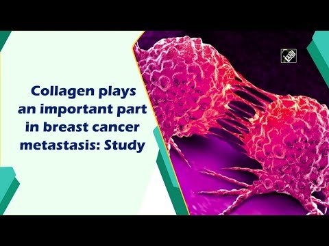 What Type of Collagen Causes Breast Cancer?here knows about 14 types of collagen.