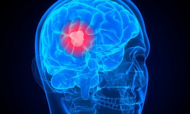 How to Detect a Brain Tumor at Home?: Symptoms and Warning Signs