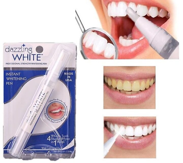 Best Teeth Whitening Pens: Amazing Gadget for a Brighter Smile😄