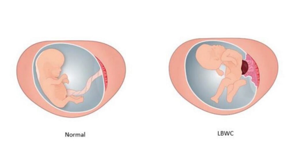 Ohio Abortion Laws