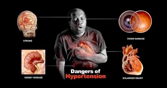 Why Is Hypertension More Common in Black?