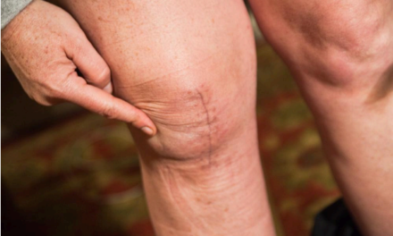 What is Post Surgical Rehabilitation & Why You Need Physical Therapy